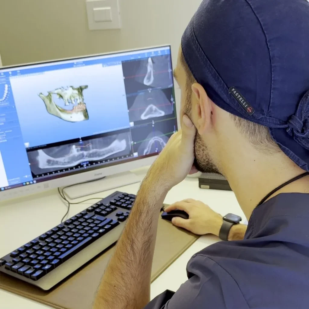 Impianto dentale a San Giovanni Lupatoto