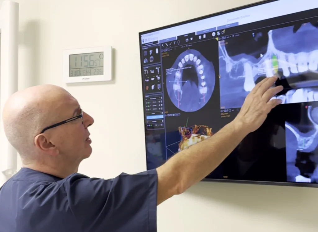 Impianti dentali: vantaggi rispetto ad altre soluzioni 1 Impianti dentali