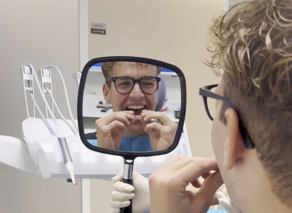 Studio dentistico a Buttapietra - Quanto dura un trattamento con apparecchio trasparente